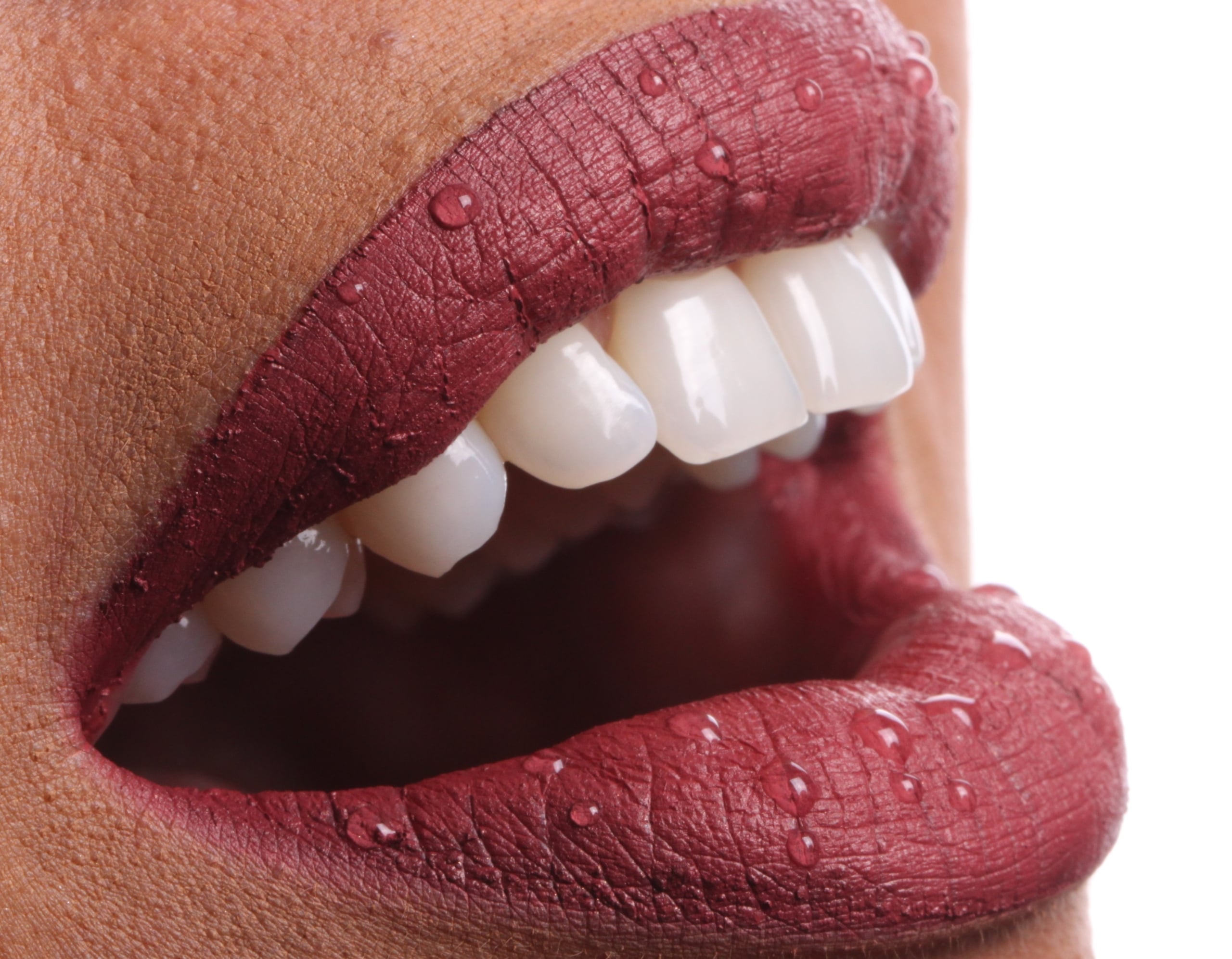 Odontologia Estética