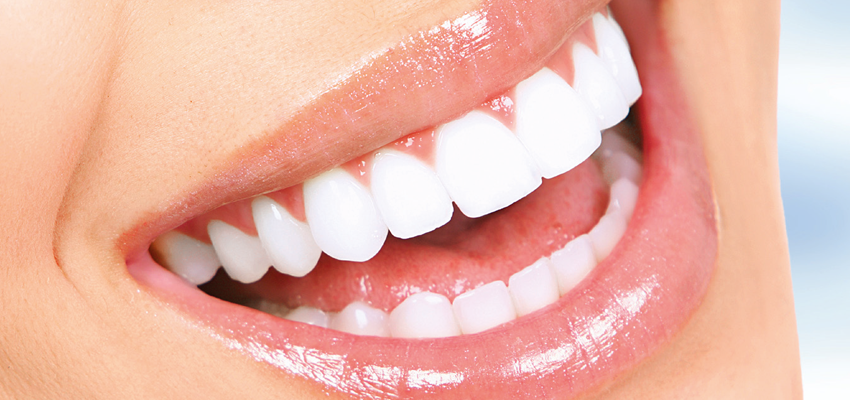Clareamento Dental