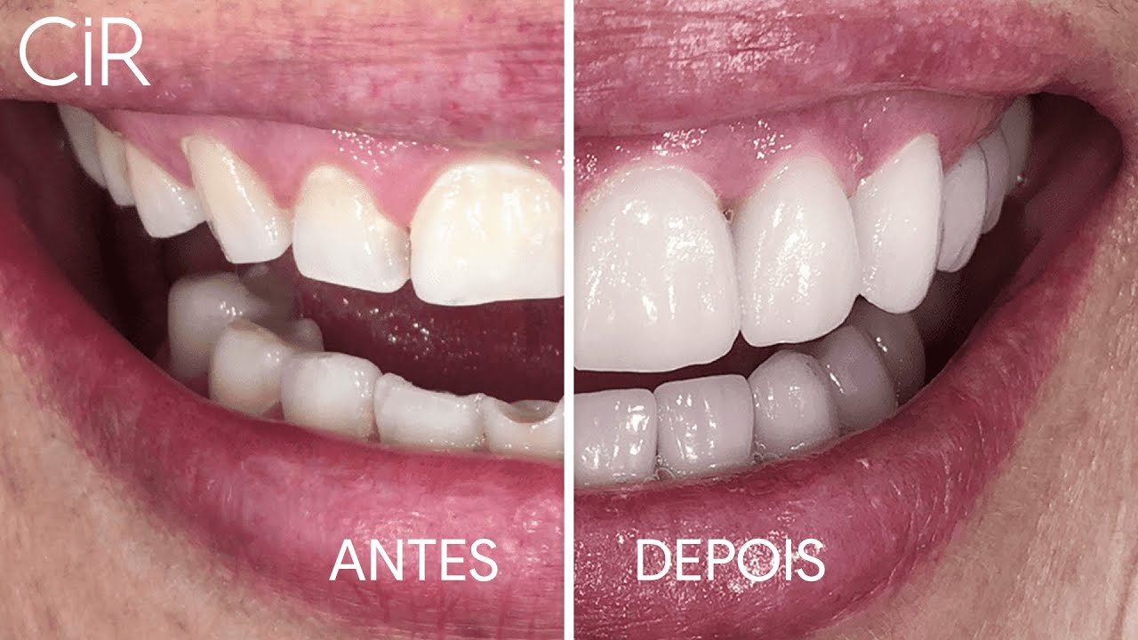Reabilitação Oral